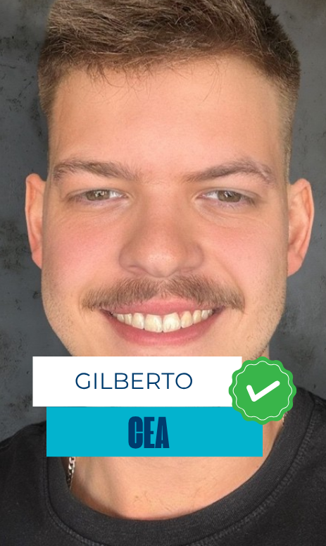 Gilberto - CEA